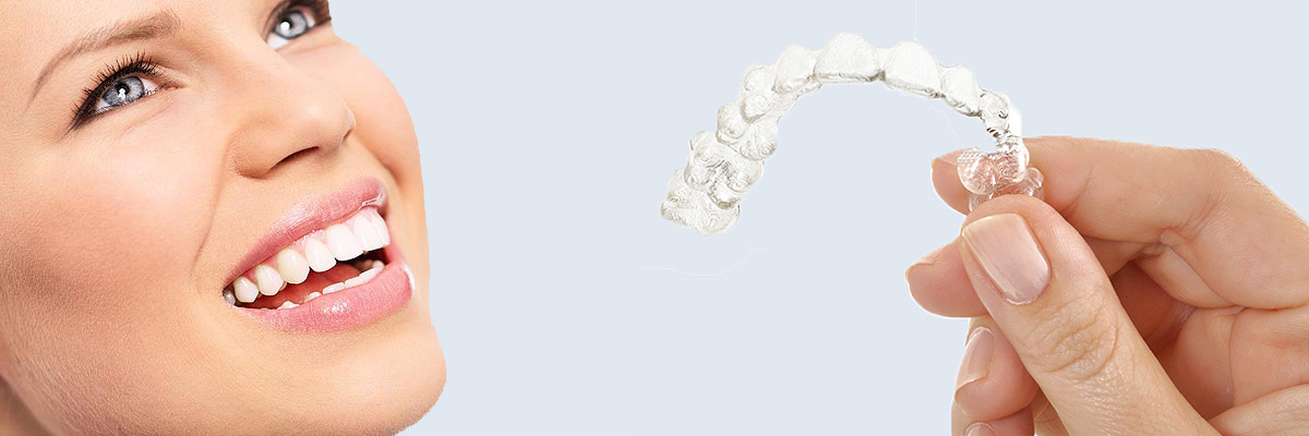 New York 7 Things Parents Need to Know About Invisalign Teen