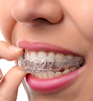 Clear Aligners - Almost Invisible Braces New York, NY