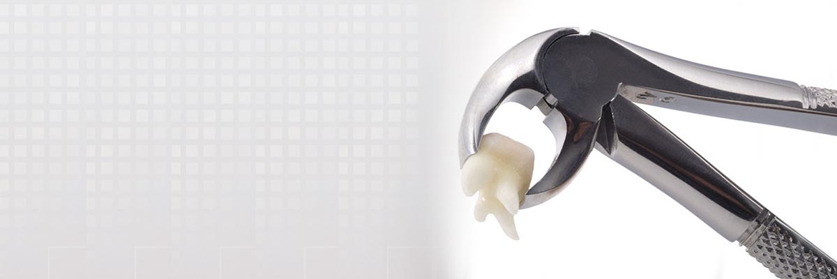 New York Tooth Extraction